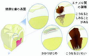 イラスト1